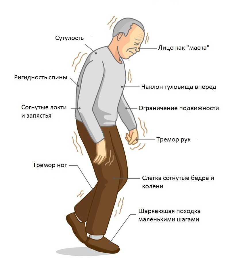 02 (1)