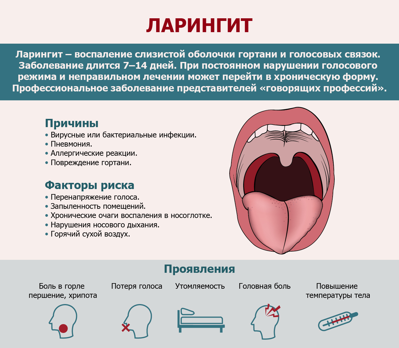 laringit-2